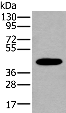 Rabbit Polyclonal Antibody to ELK1