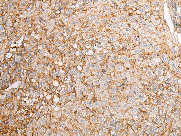 Rabbit Polyclonal Antibody to EFNA4