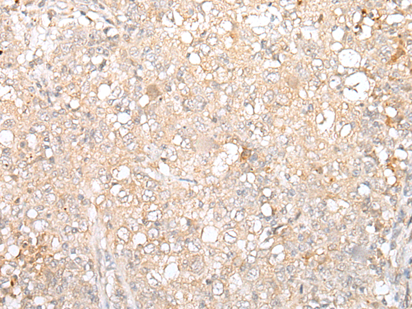 Rabbit Polyclonal Antibody to DUSP16