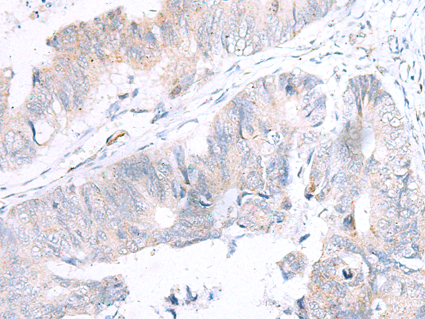 Rabbit Polyclonal Antibody to NUDT8
