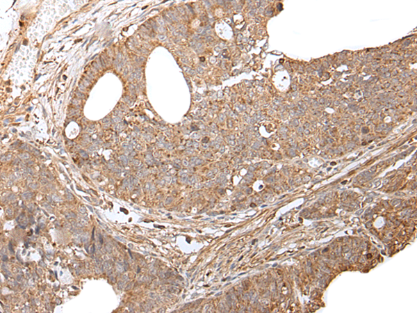 Rabbit Polyclonal Antibody to GNAI2