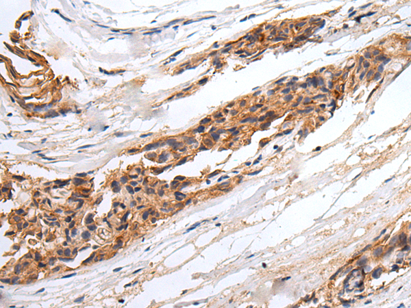 Rabbit Polyclonal Antibody to GABRR2