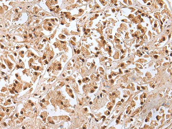 Rabbit Polyclonal Antibody to DDIT3