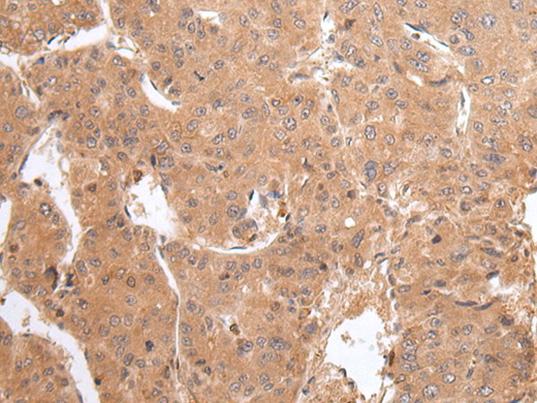 Rabbit Polyclonal Antibody to GADD45GIP1