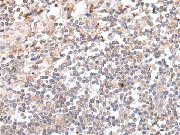 Rabbit Polyclonal Antibody to GAL