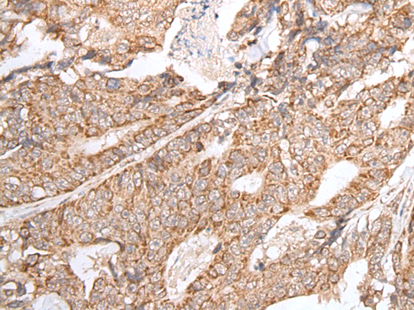 Rabbit Polyclonal Antibody to GNLY