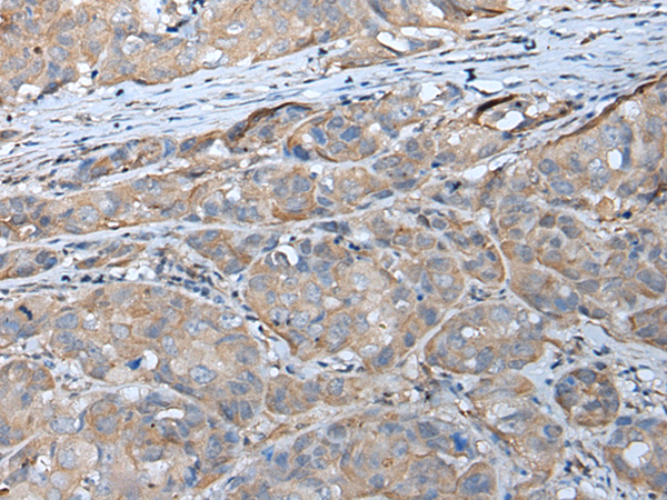 Rabbit Polyclonal Antibody to GPC5