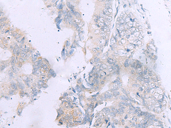 Rabbit Polyclonal Antibody to GPC3