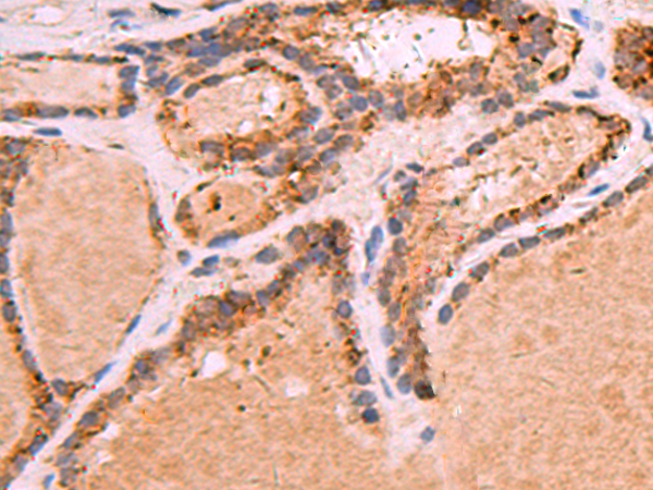Rabbit Polyclonal Antibody to GPC2