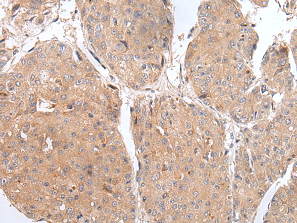 Rabbit Polyclonal Antibody to GLI3