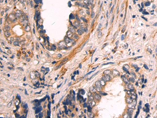 Rabbit Polyclonal Antibody to GLI1