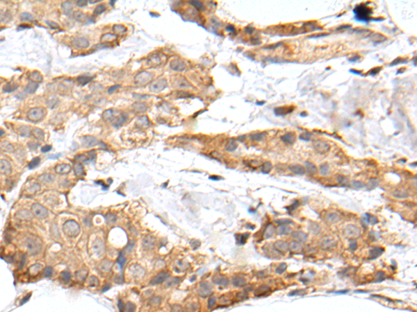 Rabbit Polyclonal Antibody to GRM4