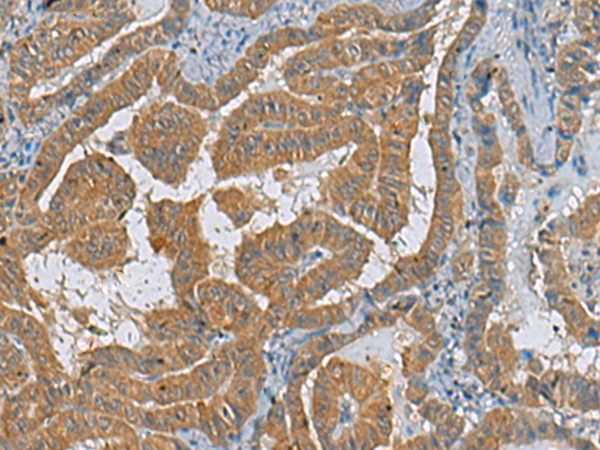 Rabbit Polyclonal Antibody to CXCL1