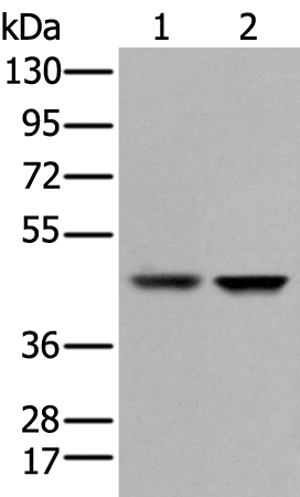 Rabbit Polyclonal Antibody to GSK3B