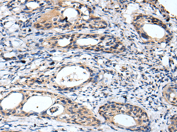 Rabbit Polyclonal Antibody to GTSE1