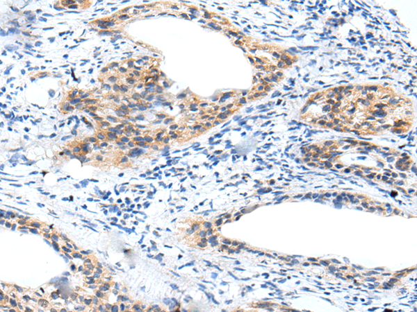 Rabbit Polyclonal Antibody to SPAM1