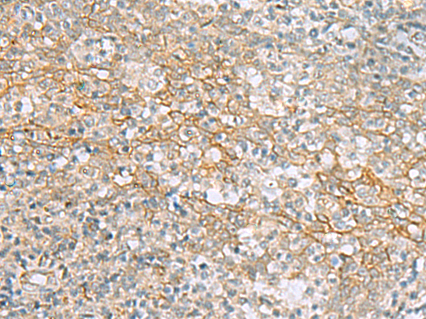 Rabbit Polyclonal Antibody to KCNH7