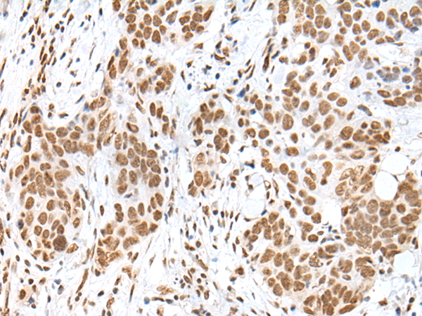 Rabbit Polyclonal Antibody to HCN3