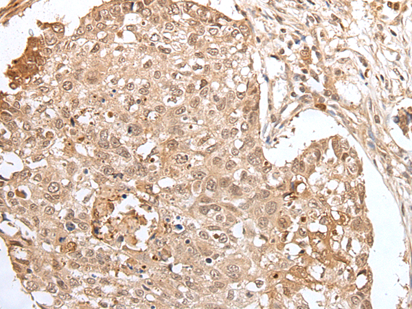 Rabbit Polyclonal Antibody to HOXA3