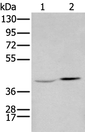 Rabbit Polyclonal Antibody to HOXA2