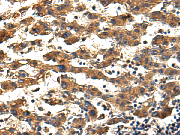 Rabbit Polyclonal Antibody to HDAC4