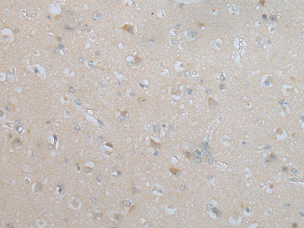 Rabbit Polyclonal Antibody to HPSE2