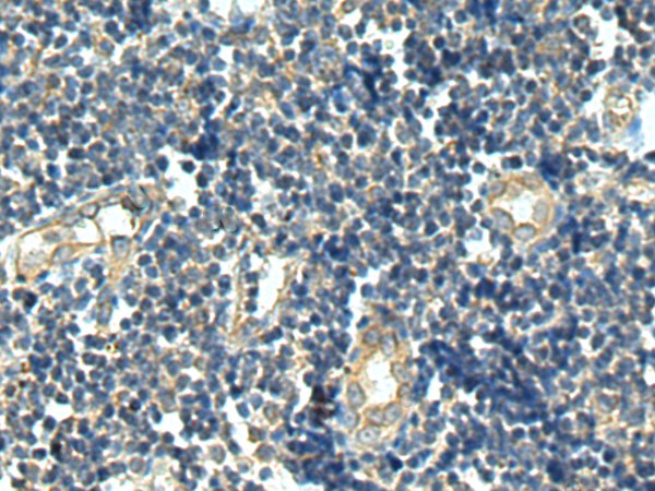 Rabbit Polyclonal Antibody to PRH2