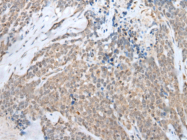 Rabbit Polyclonal Antibody to HOXB7