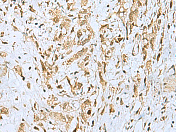 Rabbit Polyclonal Antibody to HOXC9