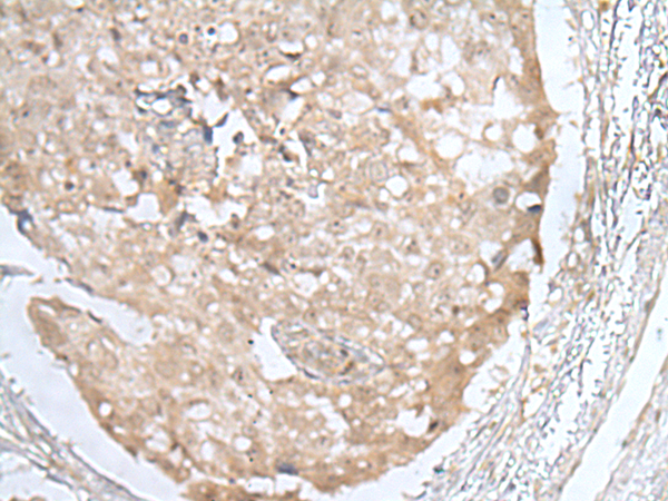 Rabbit Polyclonal Antibody to HOXD3