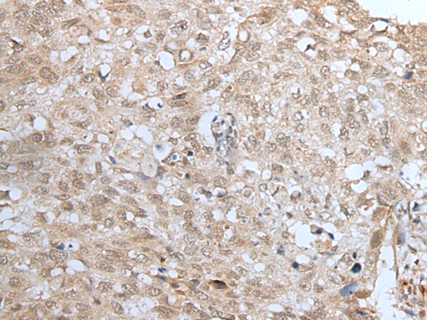 Rabbit Polyclonal Antibody to HOXD10