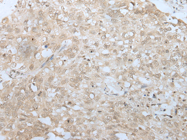 Rabbit Polyclonal Antibody to HOXD12