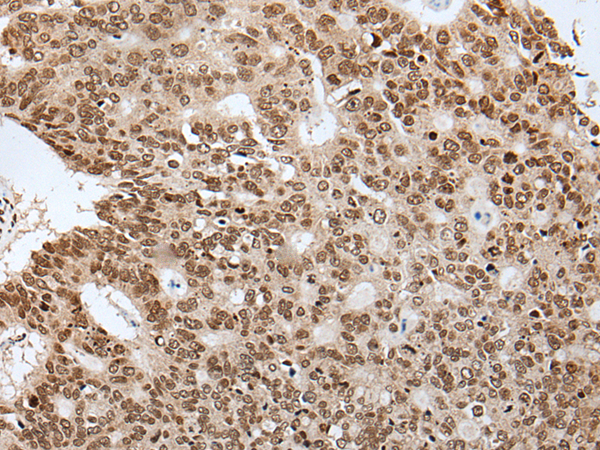 Rabbit Polyclonal Antibody to NRG1