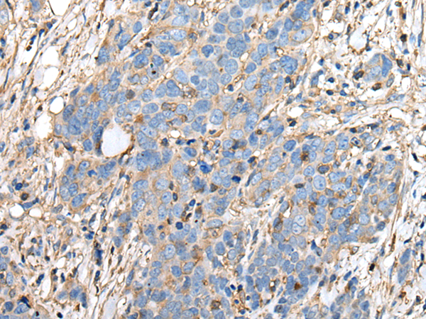 Rabbit Polyclonal Antibody to PLAAT3