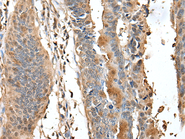 Rabbit Polyclonal Antibody to HSP90AB1