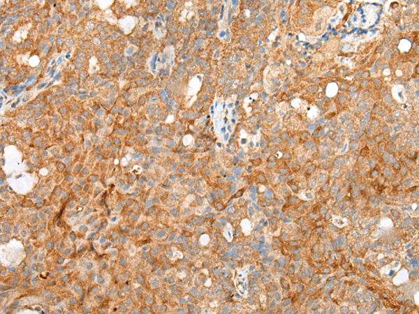 Rabbit Polyclonal Antibody to SDC2
