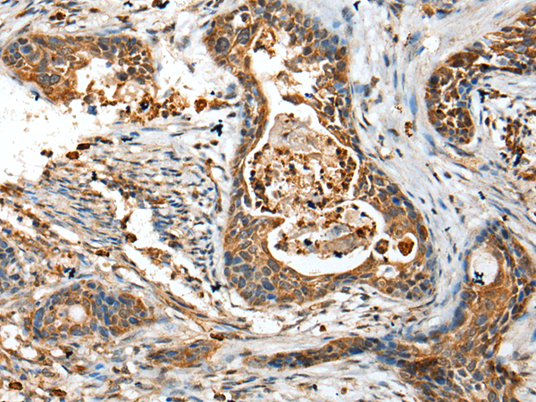 Rabbit Polyclonal Antibody to IFITM1