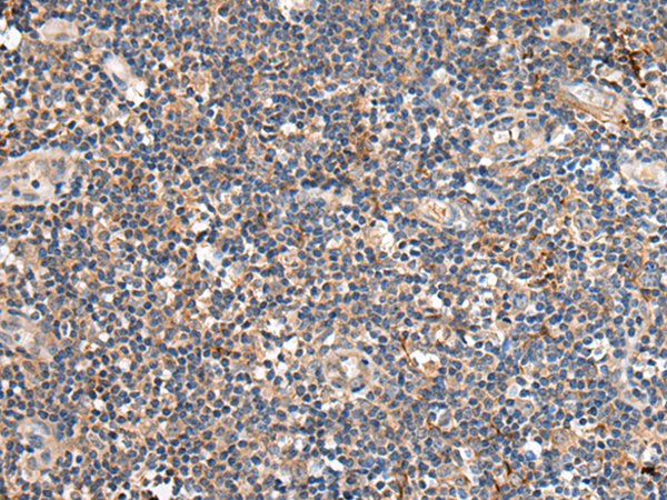 Rabbit Polyclonal Antibody to NRG1