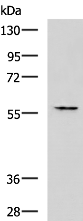 Rabbit Polyclonal Antibody to SLC16A6
