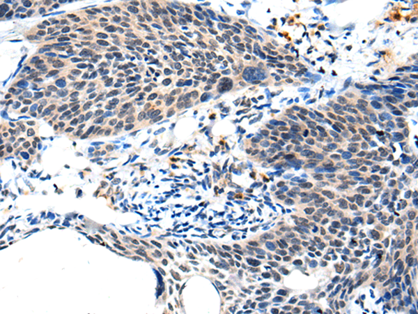 Rabbit Polyclonal Antibody to ALS2CL