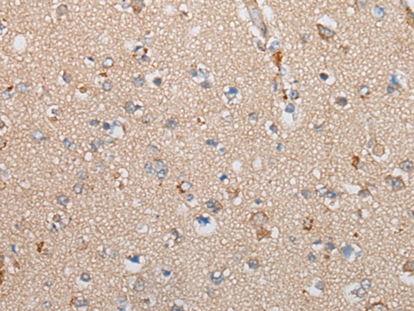 Rabbit Polyclonal Antibody to TNIK