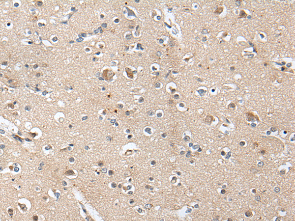 Rabbit Polyclonal Antibody to ACAN