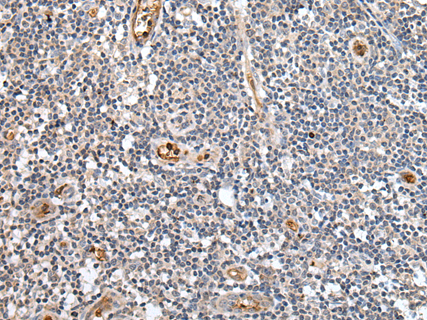 Rabbit Polyclonal Antibody to PTPRG