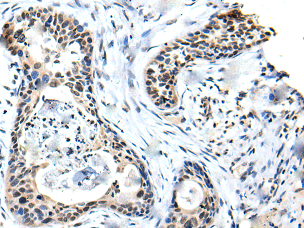 Rabbit Polyclonal Antibody to SOX4