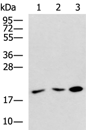 Rabbit Polyclonal Antibody to ARL5A