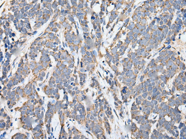 Rabbit Polyclonal Antibody to CUBN