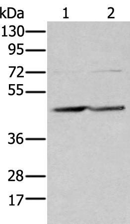 Rabbit Polyclonal Antibody to EFNB3