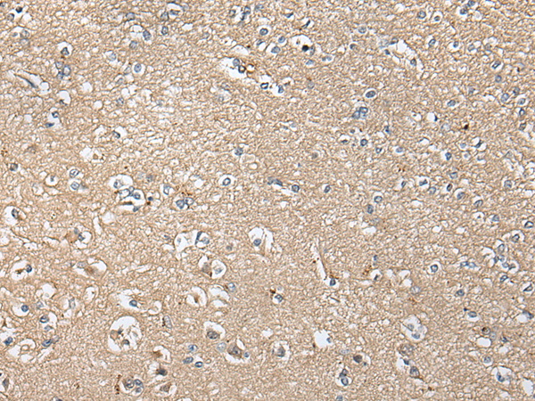 Rabbit Polyclonal Antibody to KLHL4