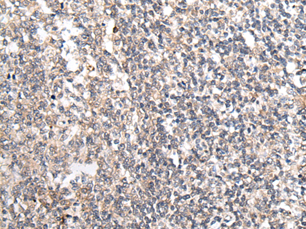 Rabbit Polyclonal Antibody to MT-ND5