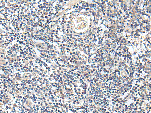 Rabbit Polyclonal Antibody to PROK1